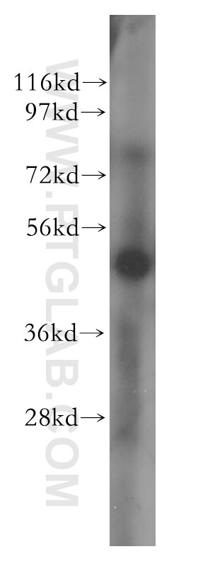 Western Blot (WB) analysis of human heart tissue using SGCE Polyclonal antibody (12407-1-AP)