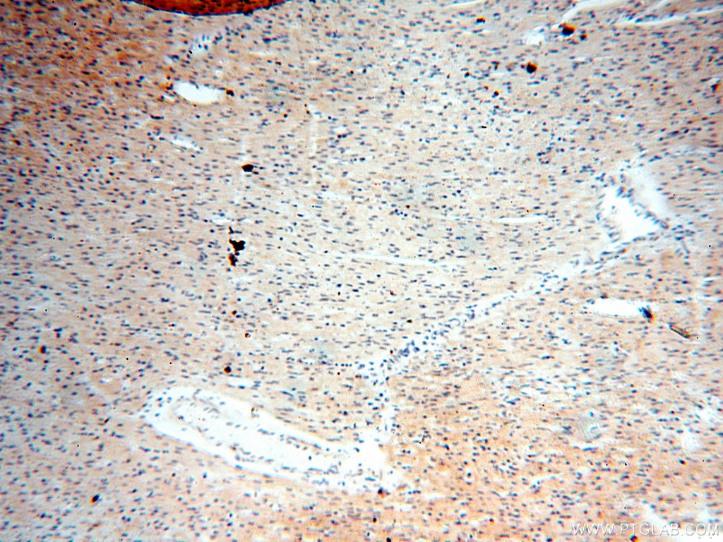 Immunohistochemistry (IHC) staining of human heart tissue using SGCG Polyclonal antibody (18102-1-AP)