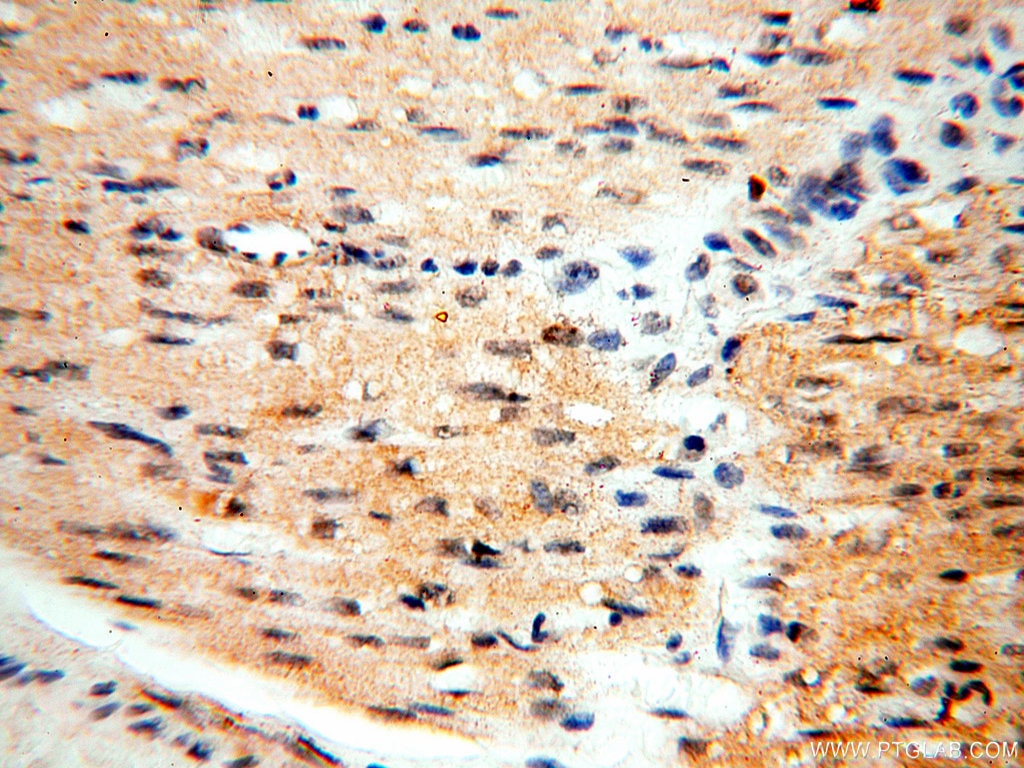 Immunohistochemistry (IHC) staining of human heart tissue using SGCG Polyclonal antibody (18102-1-AP)