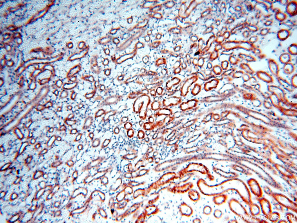 Immunohistochemistry (IHC) staining of human kidney tissue using SGCG Polyclonal antibody (18102-1-AP)