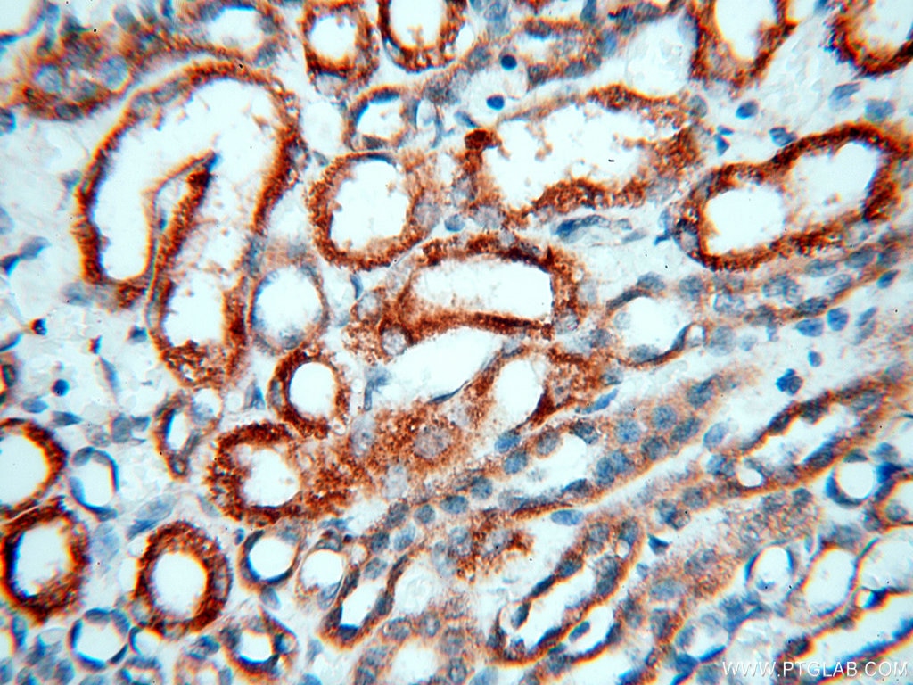 IHC staining of human kidney using 18102-1-AP