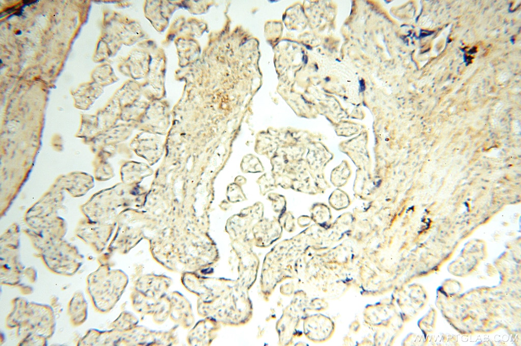 Immunohistochemistry (IHC) staining of human placenta tissue using SGCG Polyclonal antibody (18102-1-AP)