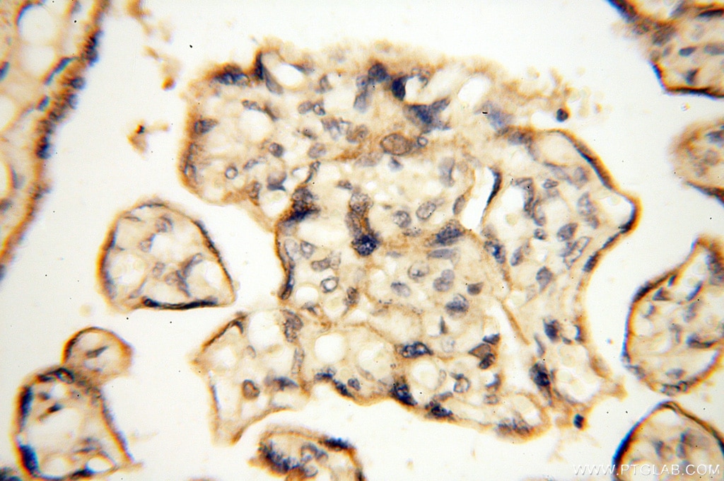 Immunohistochemistry (IHC) staining of human placenta tissue using SGCG Polyclonal antibody (18102-1-AP)