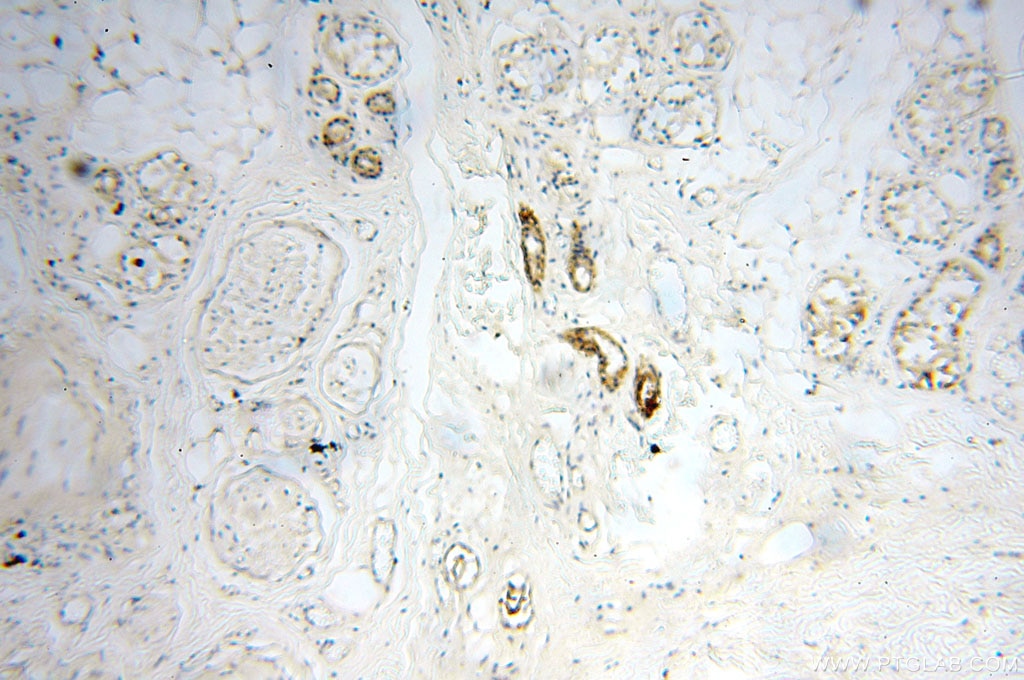 Immunohistochemistry (IHC) staining of human skin tissue using SGCG Polyclonal antibody (18102-1-AP)