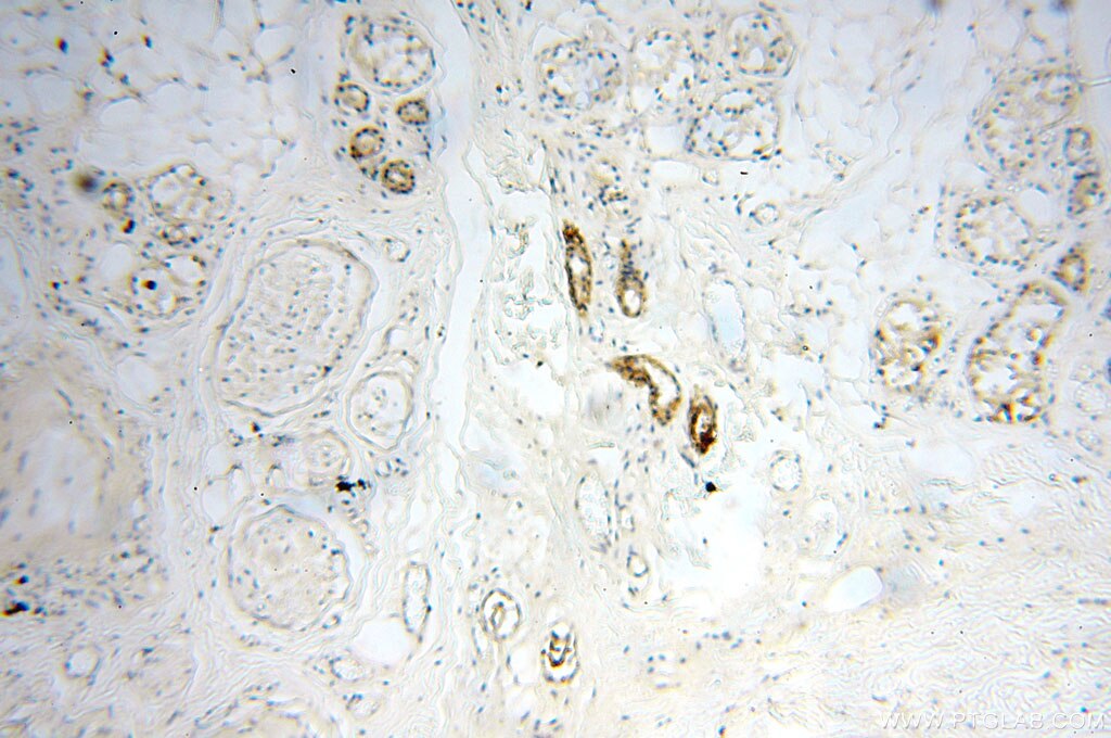 IHC staining of human skin using 18102-1-AP