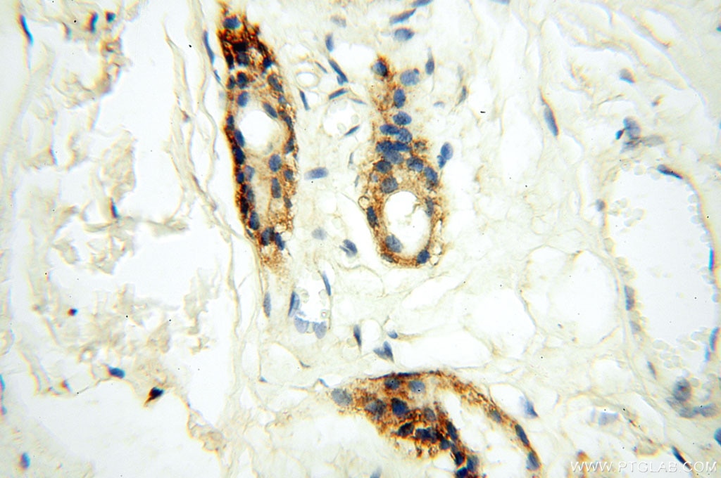 Immunohistochemistry (IHC) staining of human skin tissue using SGCG Polyclonal antibody (18102-1-AP)