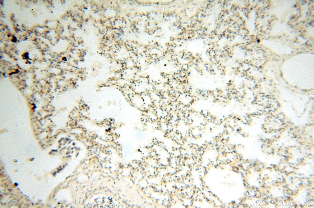 Immunohistochemistry (IHC) staining of human lung tissue using SGCG Polyclonal antibody (18102-1-AP)