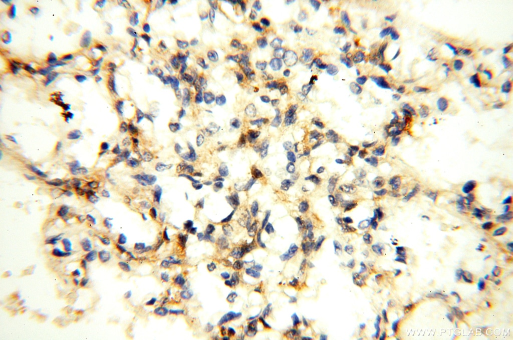 Immunohistochemistry (IHC) staining of human lung tissue using SGCG Polyclonal antibody (18102-1-AP)