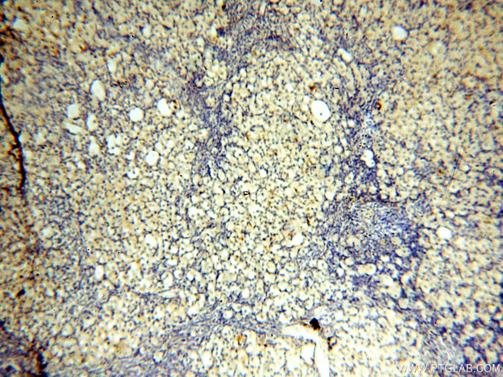 Immunohistochemistry (IHC) staining of human ovary tissue using SGCG Polyclonal antibody (18102-1-AP)