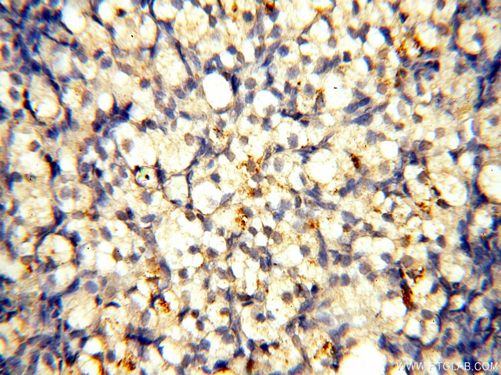 Immunohistochemistry (IHC) staining of human ovary tissue using SGCG Polyclonal antibody (18102-1-AP)