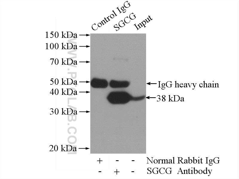 Immunoprecipitation (IP) experiment of mouse heart tissue using SGCG Polyclonal antibody (18102-1-AP)