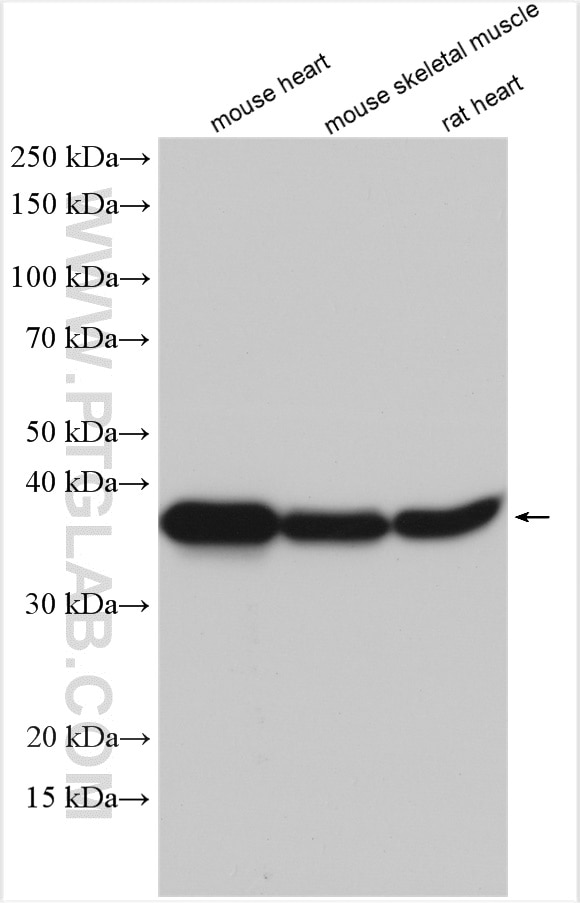 Western Blot (WB) analysis of various lysates using SGCG Polyclonal antibody (18102-1-AP)