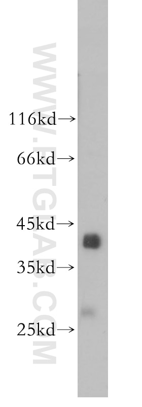 Western Blot (WB) analysis of human skeletal muscle tissue using SGCG Polyclonal antibody (18102-1-AP)