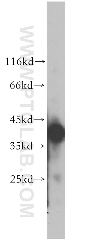 Western Blot (WB) analysis of human heart tissue using SGCG Polyclonal antibody (18102-1-AP)