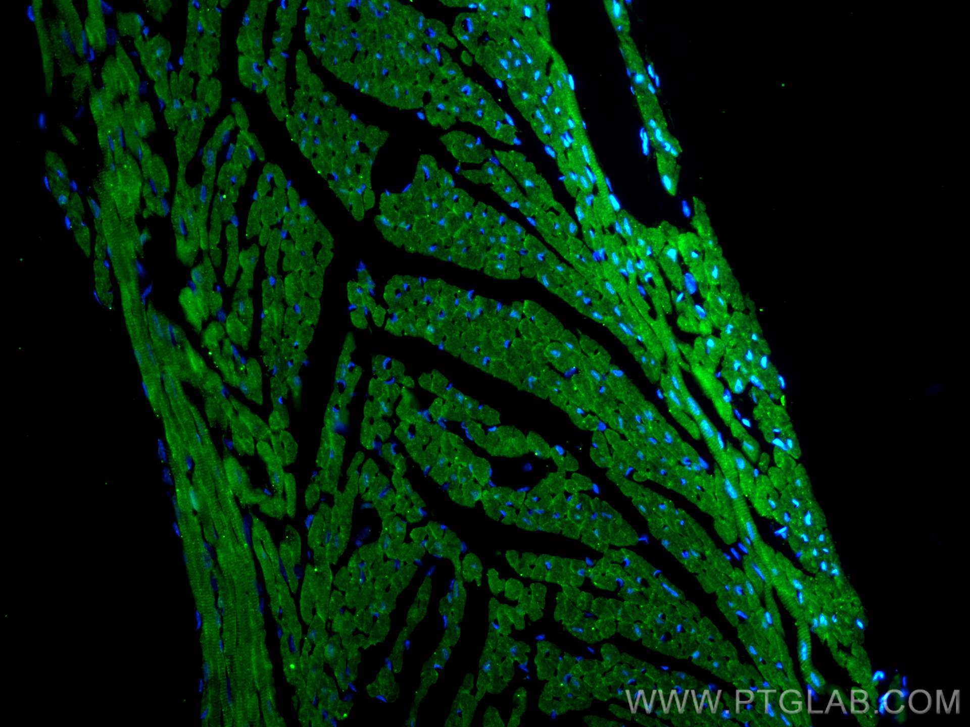 Immunofluorescence (IF) / fluorescent staining of mouse heart tissue using SGCZ Polyclonal antibody (21614-1-AP)
