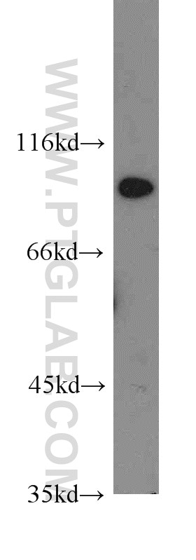 Western Blot (WB) analysis of HeLa cells using SGEF Polyclonal antibody (12493-1-AP)