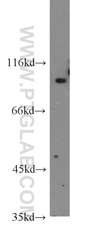 Western Blot (WB) analysis of HeLa cells using SGEF Polyclonal antibody (12493-1-AP)