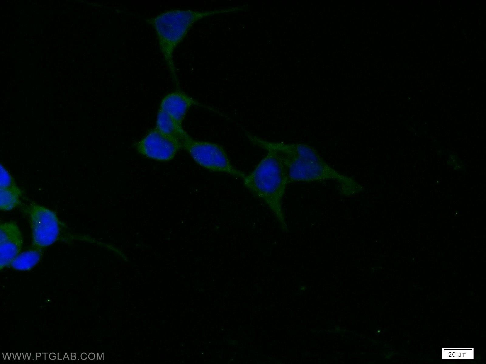 Immunofluorescence (IF) / fluorescent staining of HEK-293 cells using SGK1 Polyclonal antibody (23394-1-AP)