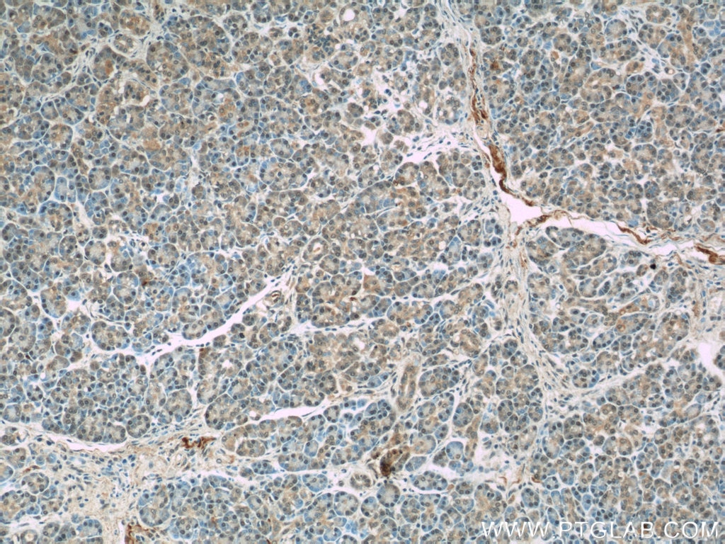 Immunohistochemistry (IHC) staining of human pancreas tissue using SGK1 Polyclonal antibody (23394-1-AP)