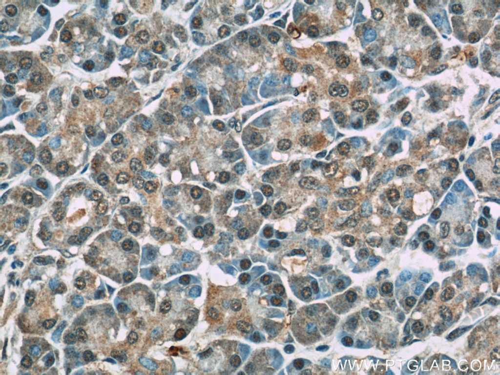 Immunohistochemistry (IHC) staining of human pancreas tissue using SGK1 Polyclonal antibody (23394-1-AP)