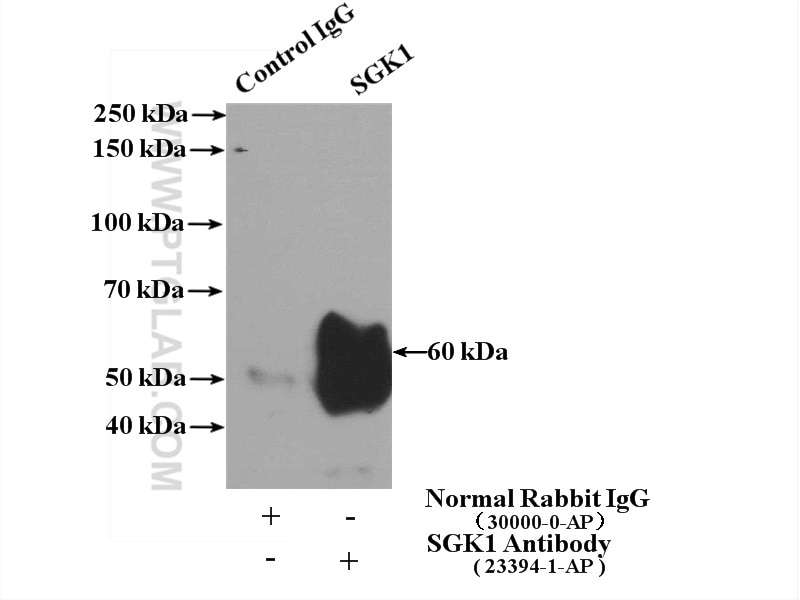 Immunoprecipitation (IP) experiment of HEK-293 cells using SGK1 Polyclonal antibody (23394-1-AP)