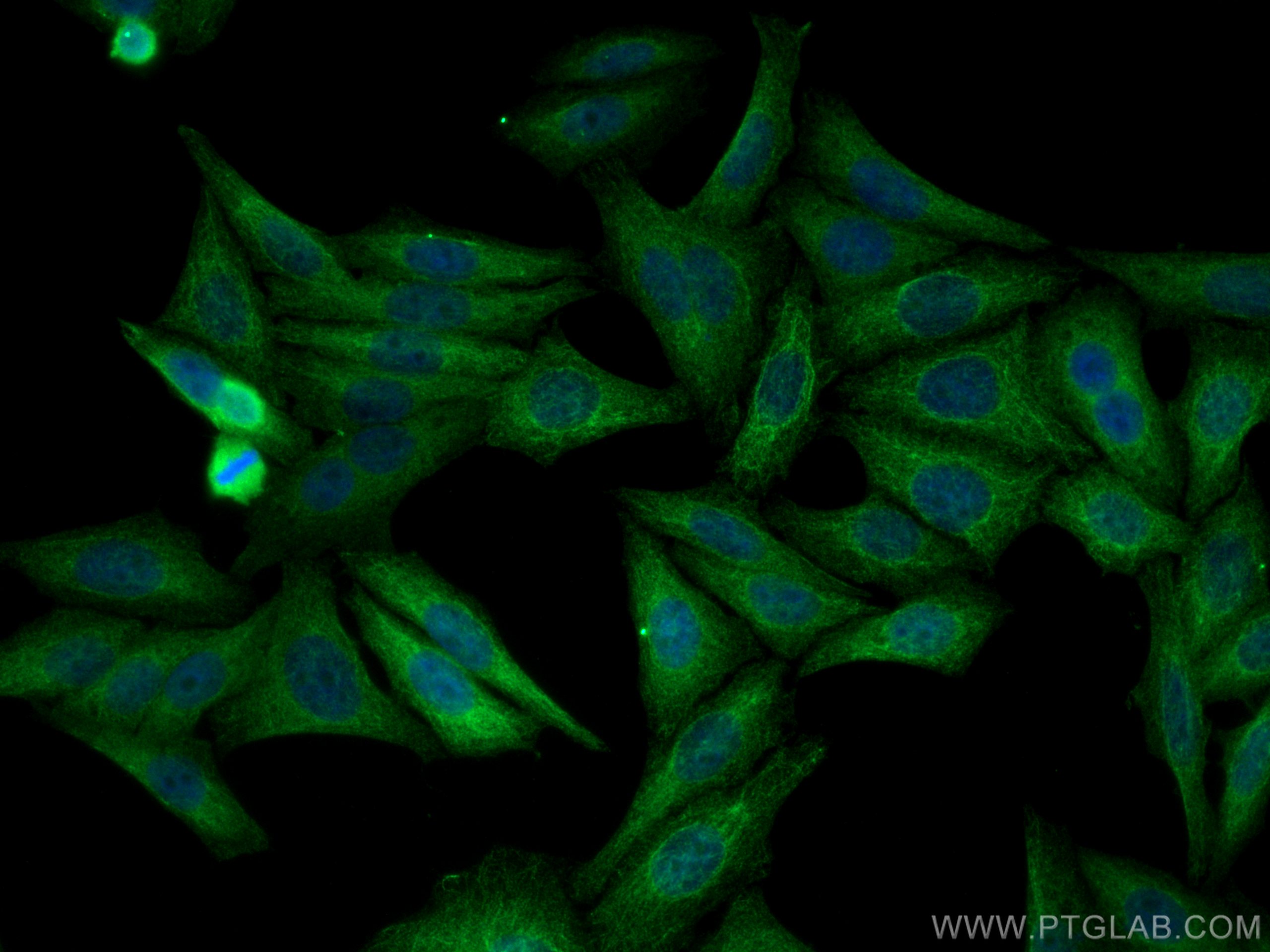 Immunofluorescence (IF) / fluorescent staining of HepG2 cells using SGK1 Polyclonal antibody (28454-1-AP)
