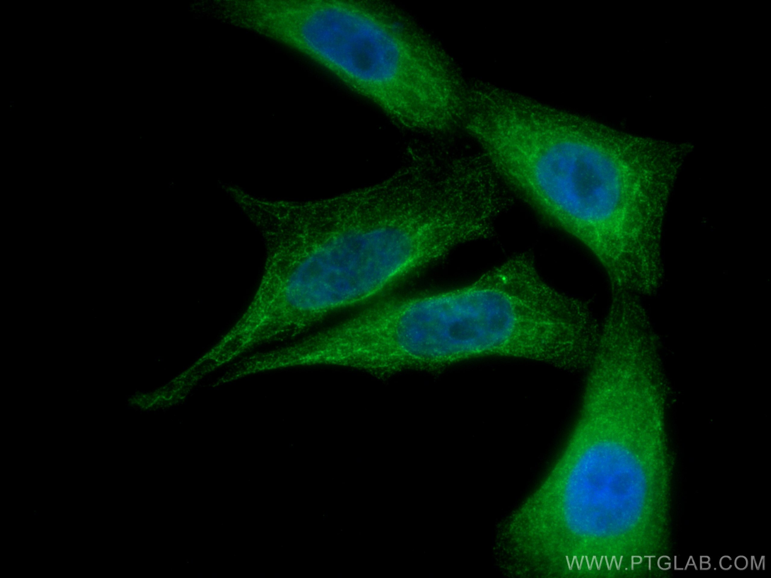 Immunofluorescence (IF) / fluorescent staining of HepG2 cells using SGK1 Polyclonal antibody (28454-1-AP)