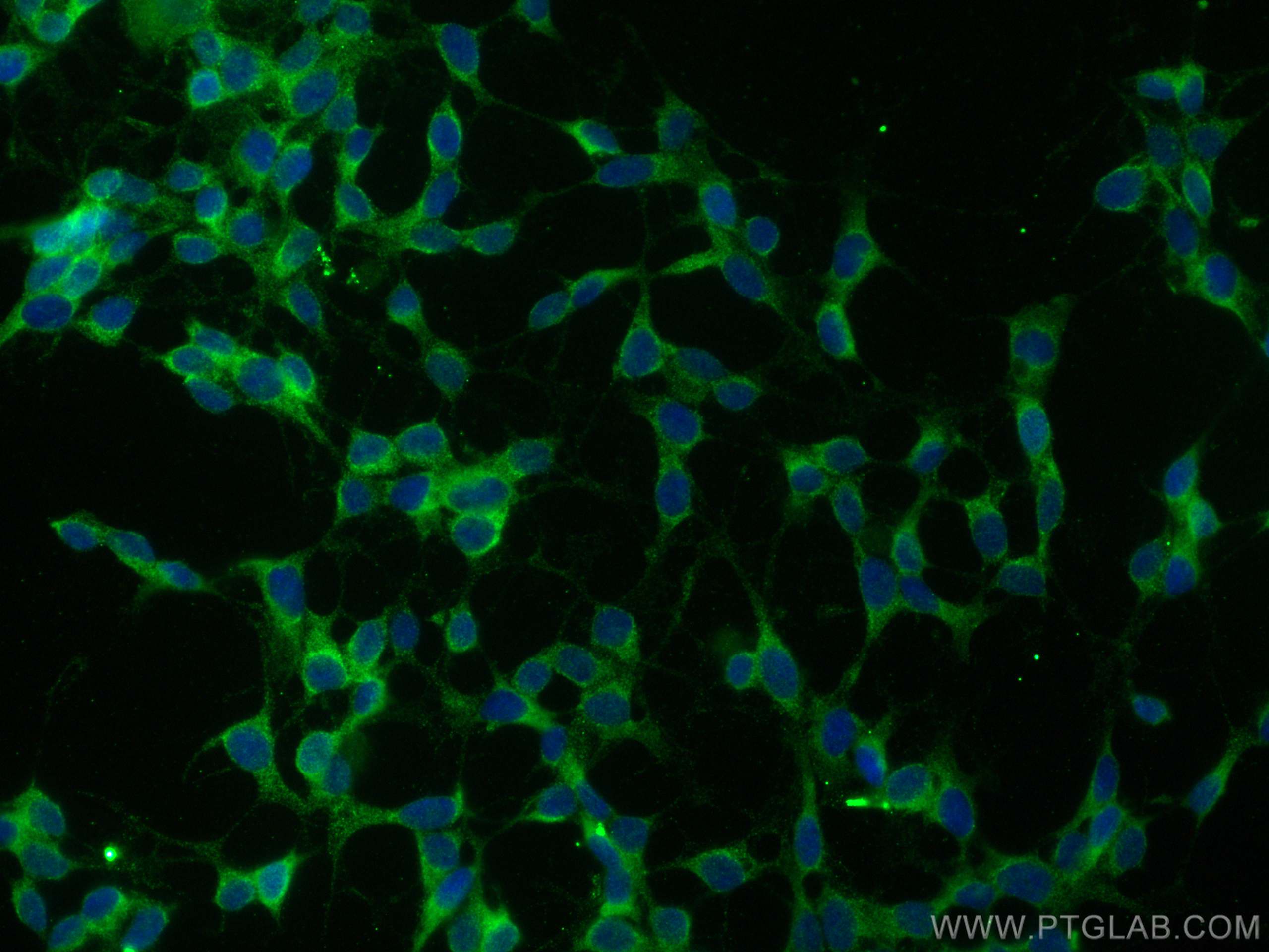 Immunofluorescence (IF) / fluorescent staining of SH-SY5Y cells using SGK1 Polyclonal antibody (28454-1-AP)