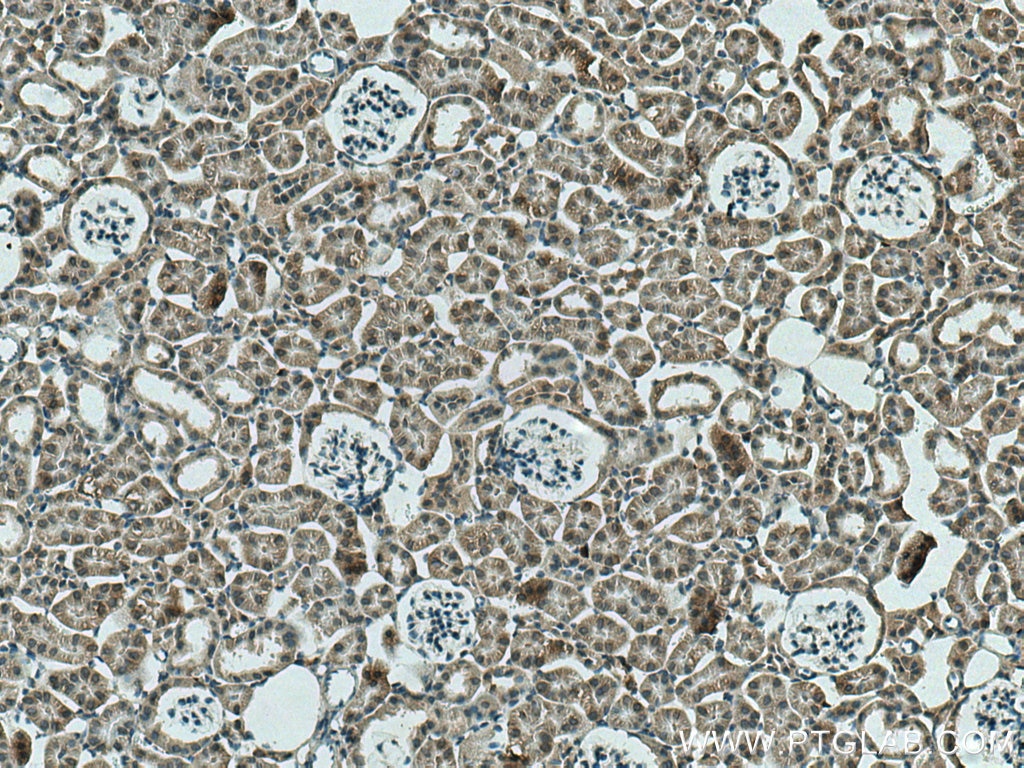 Immunohistochemistry (IHC) staining of mouse kidney tissue using SGK1 Polyclonal antibody (28454-1-AP)