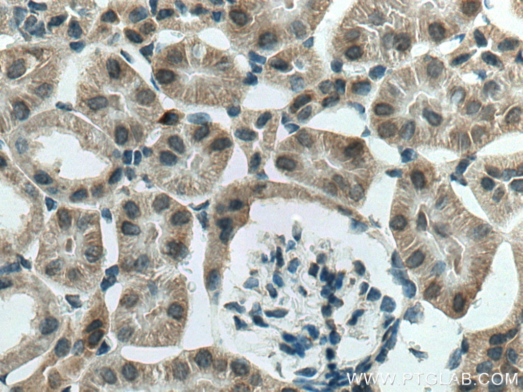 Immunohistochemistry (IHC) staining of mouse kidney tissue using SGK1 Polyclonal antibody (28454-1-AP)