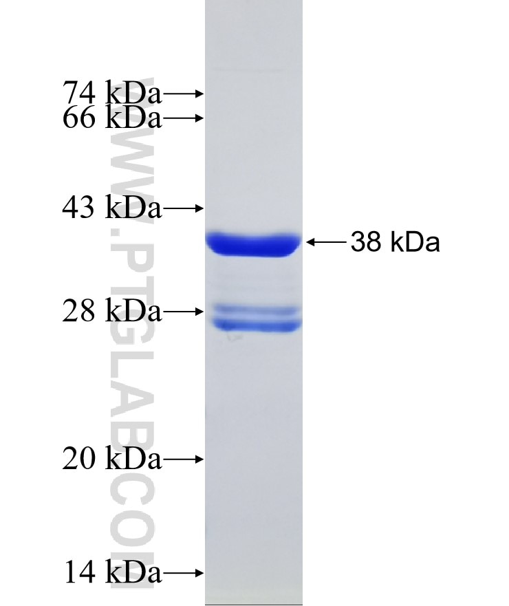 SGK1 fusion protein Ag29420 SDS-PAGE