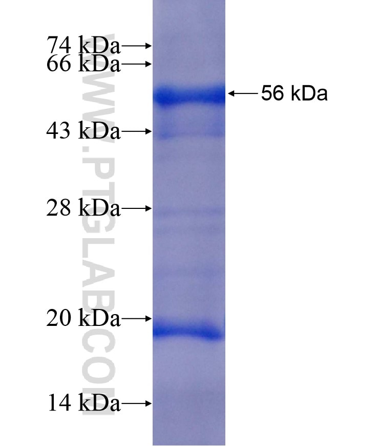 SGK1 fusion protein Ag17888 SDS-PAGE