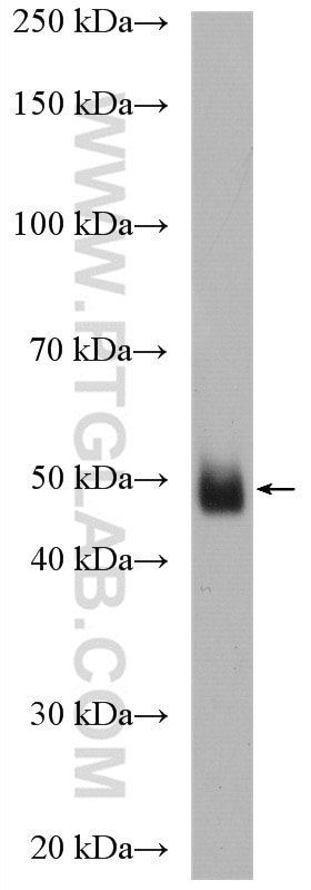 Western Blot (WB) analysis of human placenta tissue using SGK2 Polyclonal antibody (11185-1-AP)