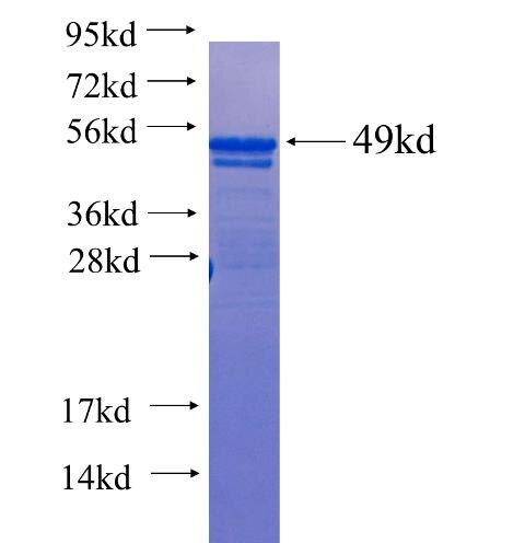 SGK2 fusion protein Ag25511 SDS-PAGE