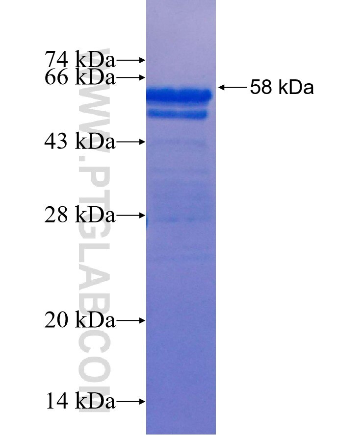 SGK2 fusion protein Ag25511 SDS-PAGE