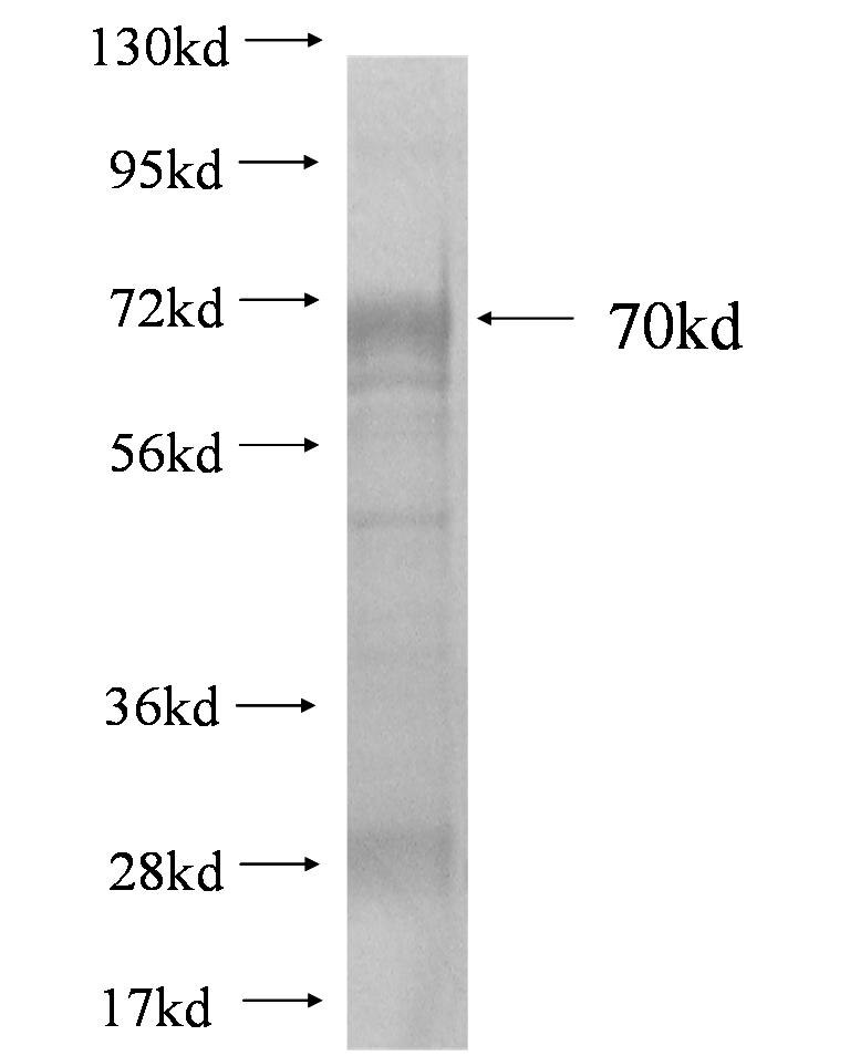 SGK2 fusion protein Ag1669 SDS-PAGE