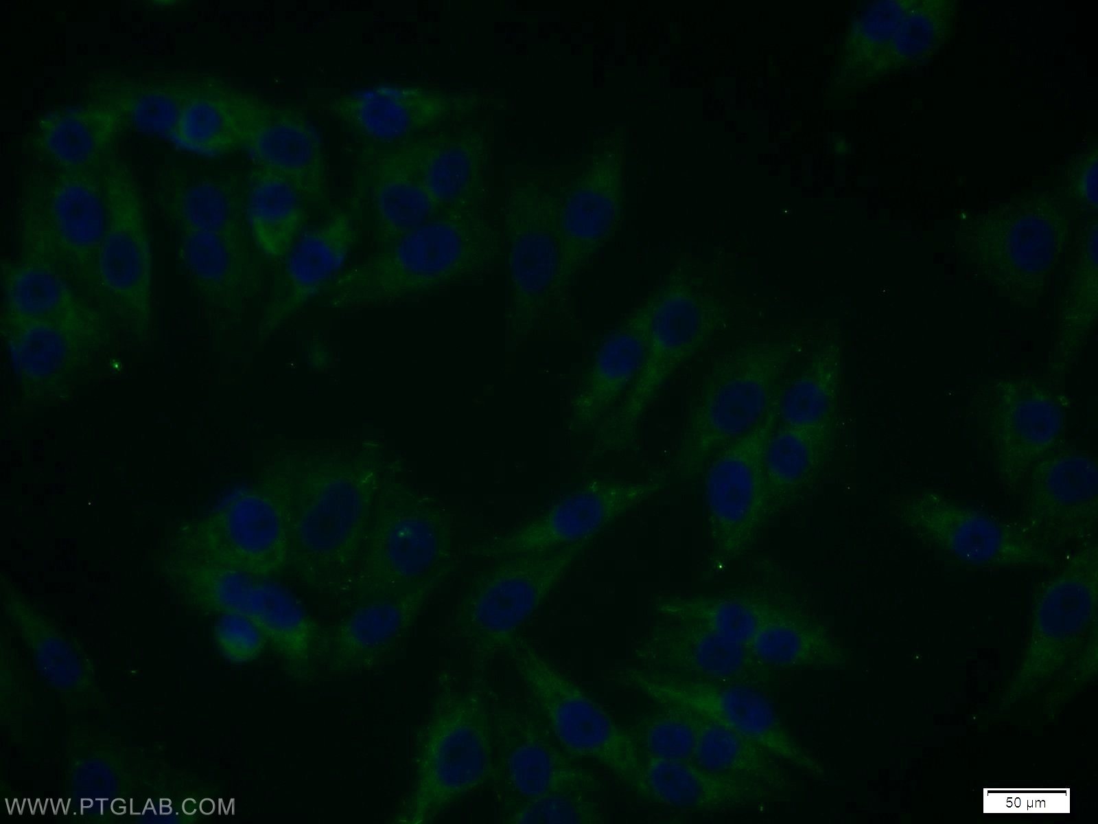 Immunofluorescence (IF) / fluorescent staining of A375 cells using SGK3 Polyclonal antibody (12699-1-AP)