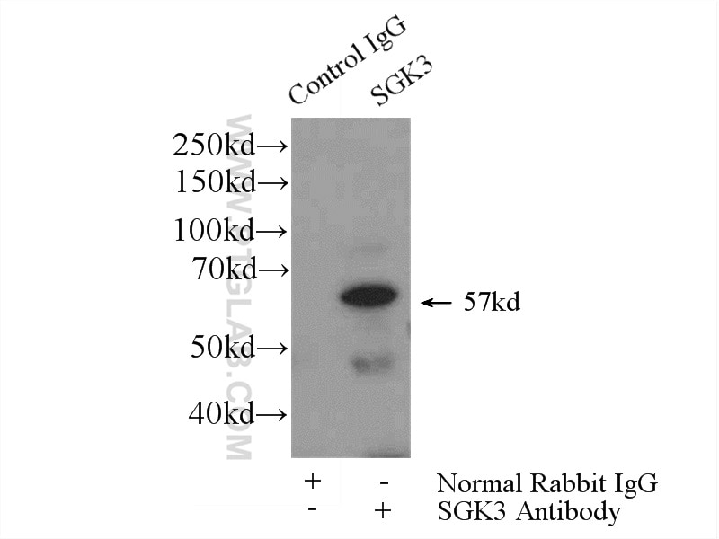 Immunoprecipitation (IP) experiment of mouse heart tissue using SGK3 Polyclonal antibody (12699-1-AP)