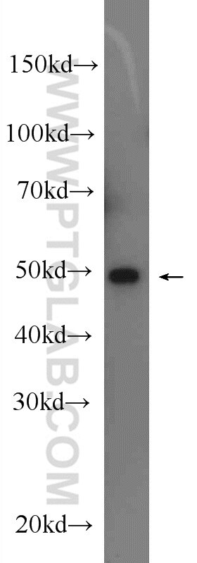 Western Blot (WB) analysis of rat kidney tissue using SGK3 Polyclonal antibody (12699-1-AP)