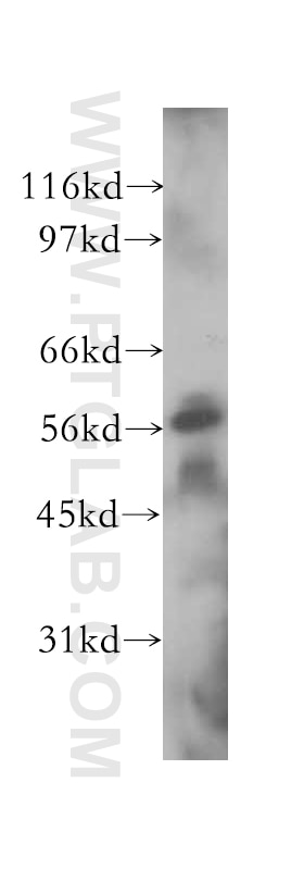Western Blot (WB) analysis of human liver tissue using SGK3 Polyclonal antibody (12699-1-AP)