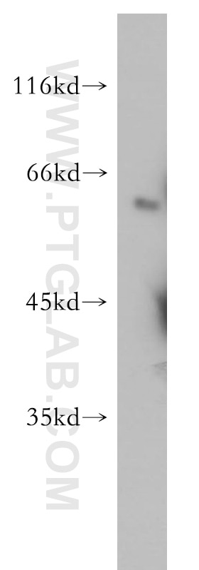 Western Blot (WB) analysis of HeLa cells using SGK3 Polyclonal antibody (12699-1-AP)