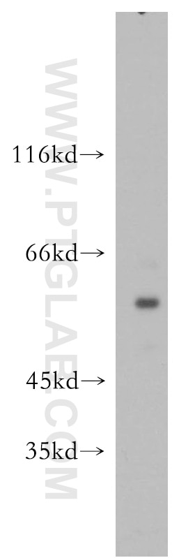 Western Blot (WB) analysis of A375 cells using SGK3 Polyclonal antibody (12699-1-AP)