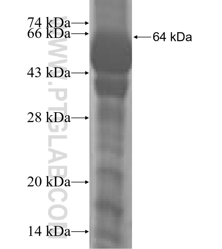 SGK3 fusion protein Ag3149 SDS-PAGE
