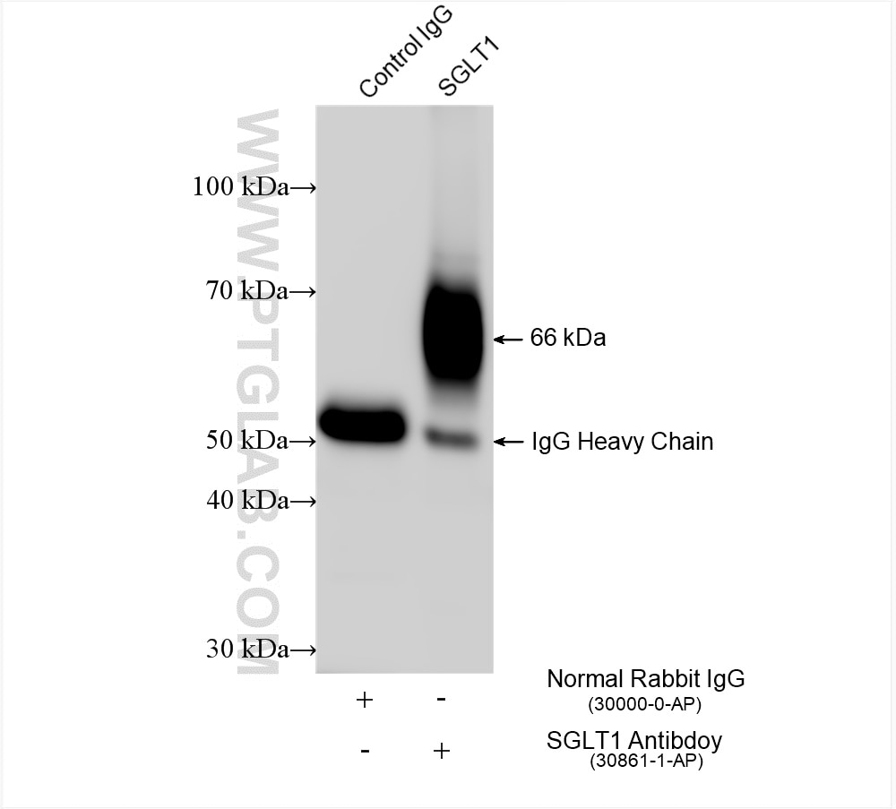 Immunoprecipitation (IP) experiment of mouse kidney tissue using mouse SGLT1 Polyclonal antibody (30861-1-AP)