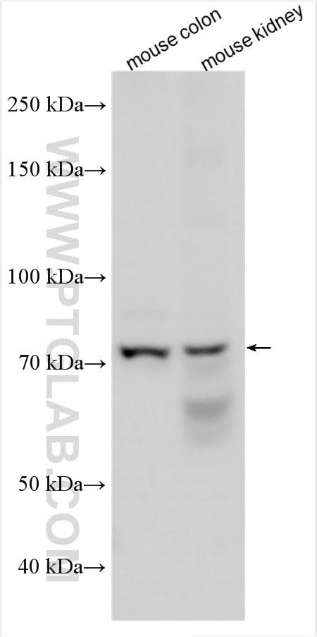 Western Blot (WB) analysis of various lysates using SGLT1 Polyclonal antibody (30861-1-AP)