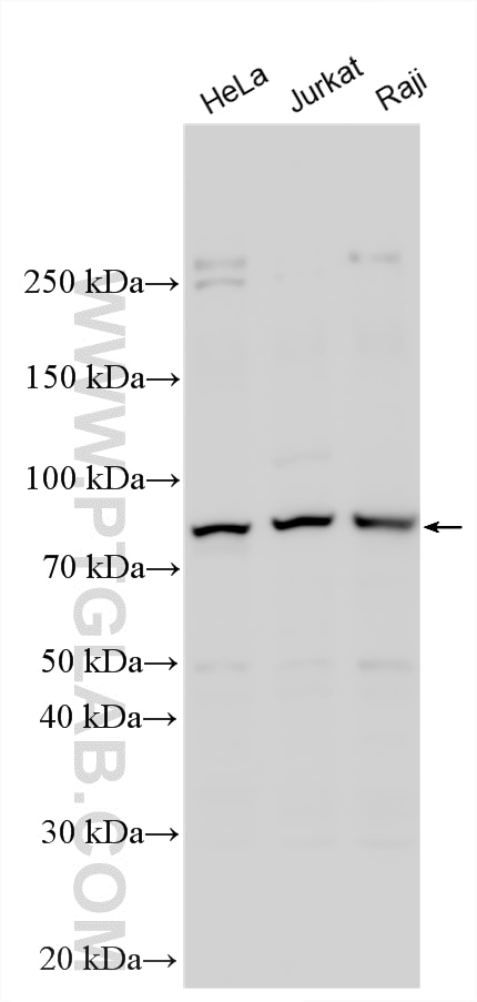 Various lysates were subjected to SDS PAGE followed by western blot with 30861-1-AP (SGLT1 antibody) at dilution of 1:1000 incubated at room temperature for 1.5 hours. Western Blot (WB) analysis of various lysates using SGLT1 Polyclonal antibody (30861-1-AP)