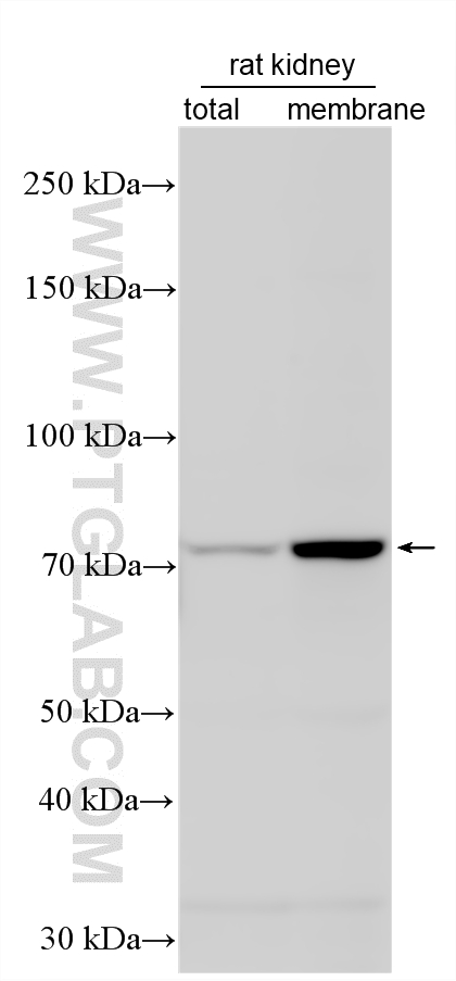 Various lysates were subjected to SDS PAGE followed by western blot with 30861-1-AP (SGLT1 antibody) at dilution of 1:1000 incubated at room temperature for 1.5 hours. Western Blot (WB) analysis of various lysates using SGLT1 Polyclonal antibody (30861-1-AP)
