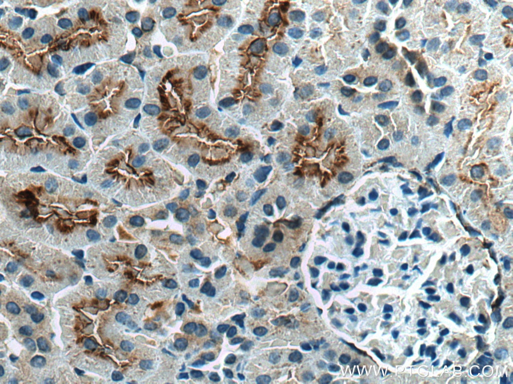 Immunohistochemistry (IHC) staining of rat kidney tissue using SGLT2 Polyclonal antibody (24654-1-AP)