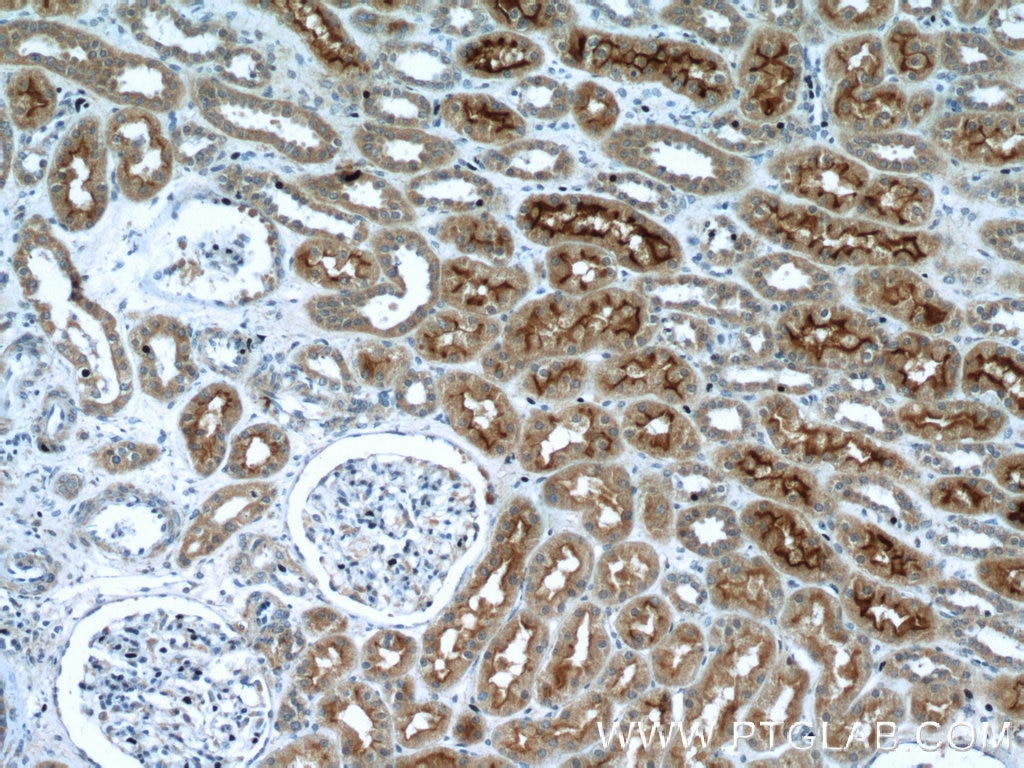 Immunohistochemistry (IHC) staining of human kidney tissue using SGLT2 Polyclonal antibody (24654-1-AP)