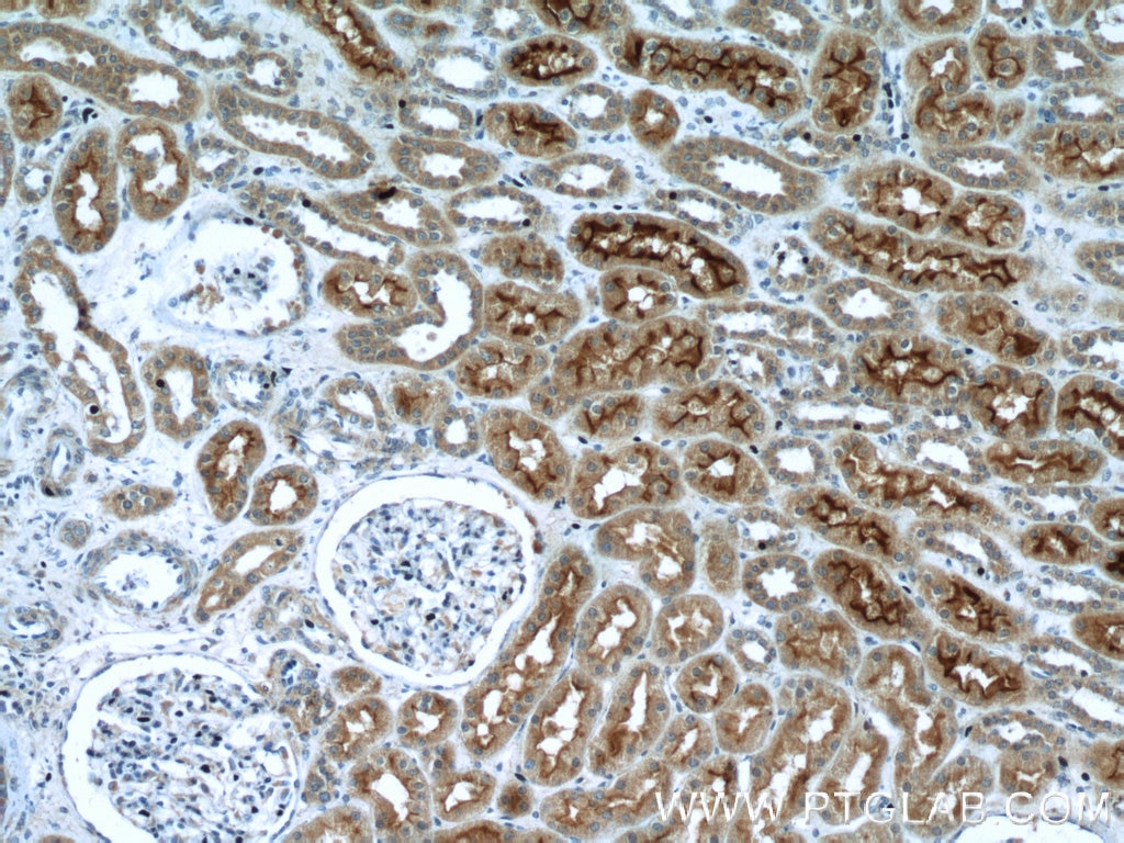 IHC staining of human kidney using 24654-1-AP